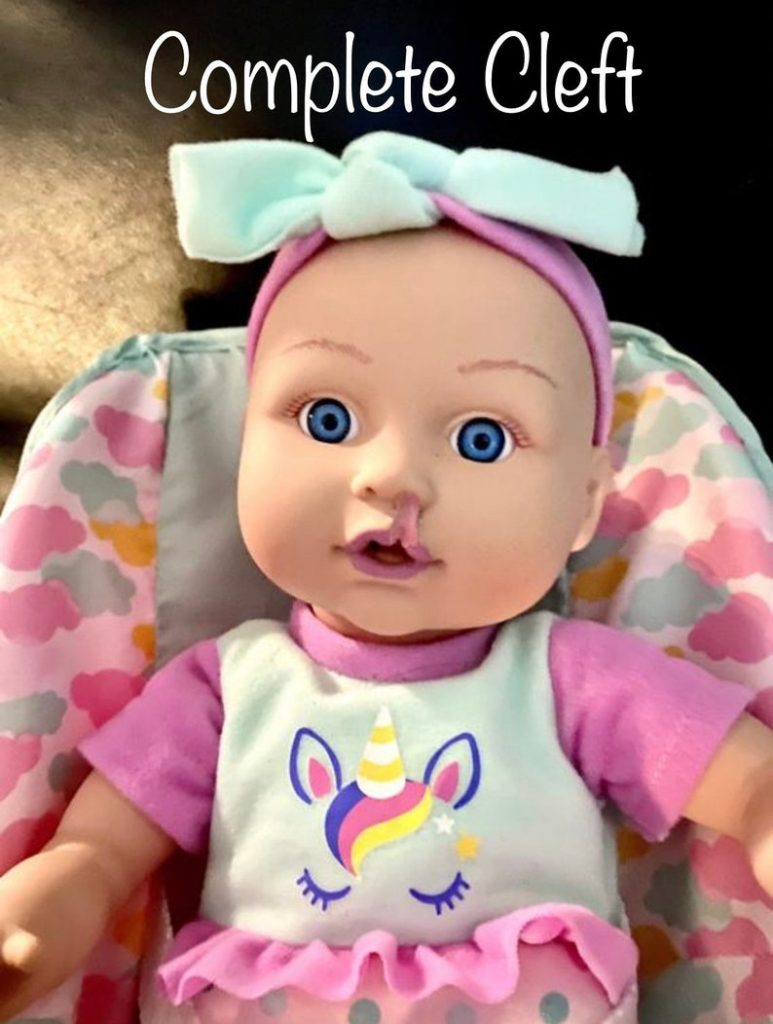 Image of vinyl baby doll with cleft lip, links to Etsy seller.